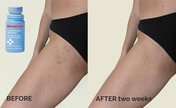 Reveal Your Confident, Smooth Skin Today!