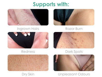 Reveal Your Confident, Smooth Skin Today!